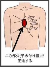 胸骨圧迫の両手の置き方の図