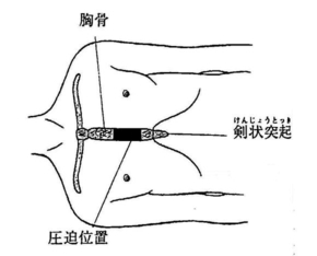 胸骨圧迫位置を図で解説している